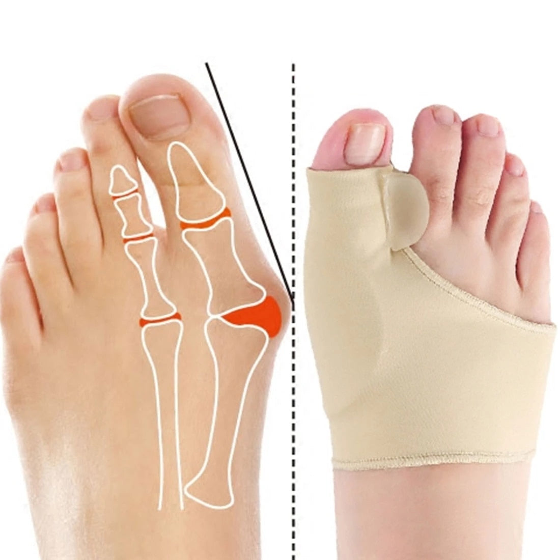 ToeCorrector™ | Put your toes in the right position without surgery! (2pcs)