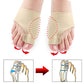 ToeCorrector™ | Put your toes in the right position without surgery! (2pcs)